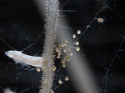<i>R. irregularis</i> Spore and Hyphae Micrograph