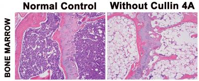Bone Marrow with and without Cullin 4A