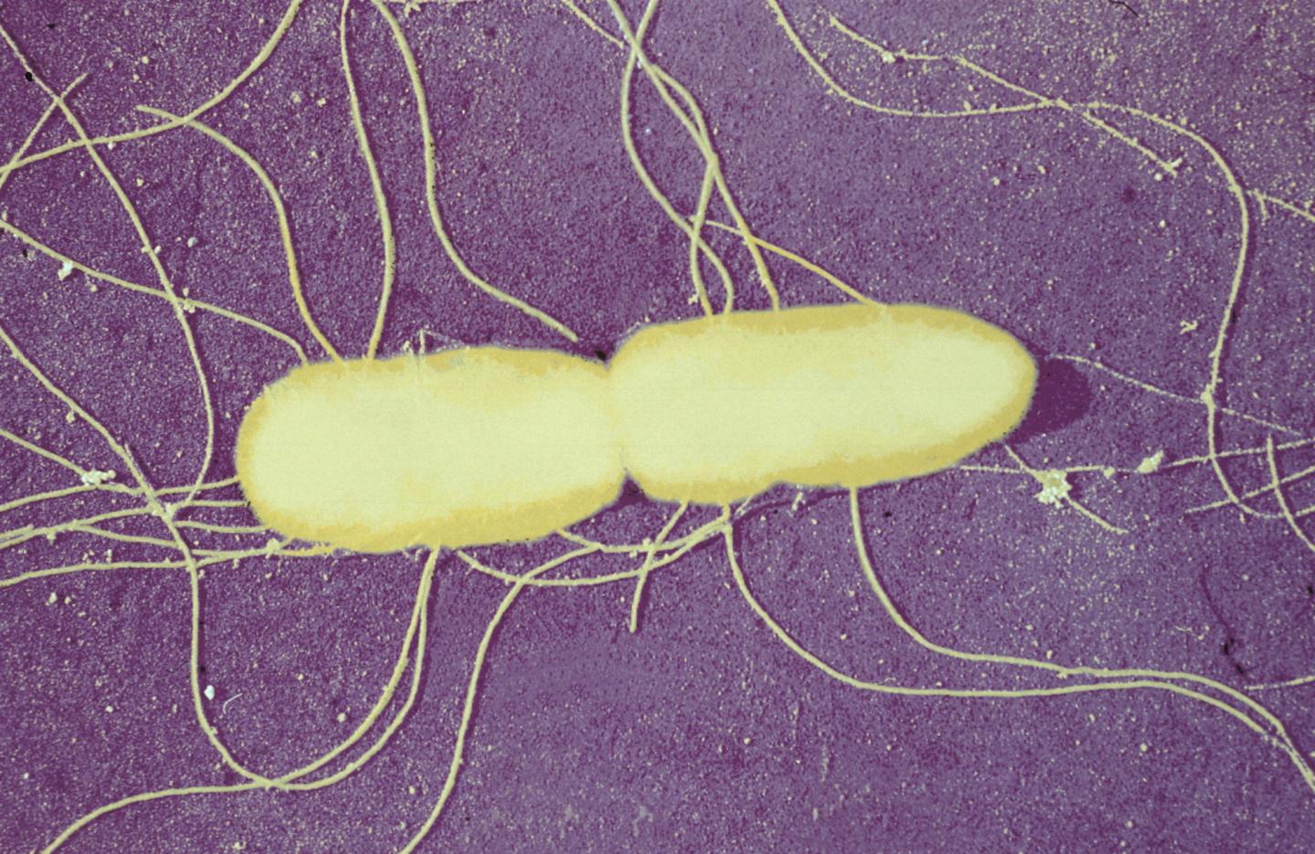 <i>Salmonella typhimurium</i>