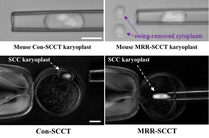 Novel procedure reduces the risk of mitochondrial disease transmission