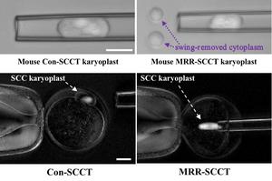 Novel procedure reduces the risk of mitochondrial disease transmission