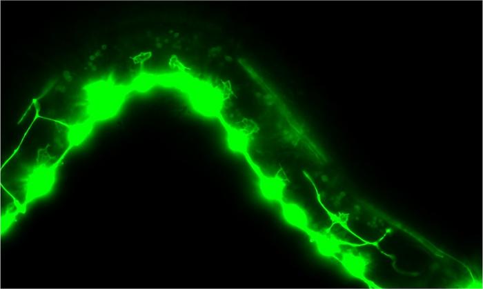 Malformed axonal growth cones in C. elegans worm