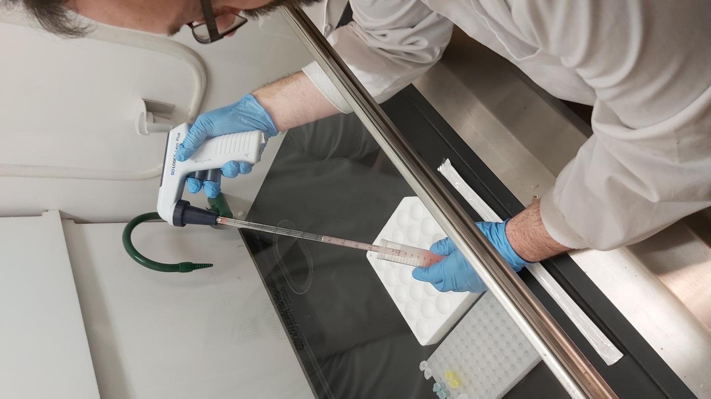 Researcher pipettes blood samples