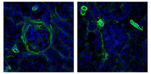 Antibody treats Nephritis