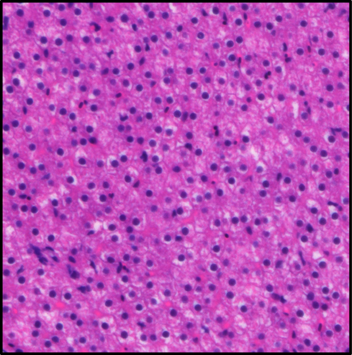 H&E staining of zebrafish liver section after SVCV infection