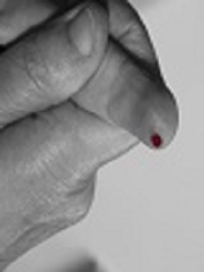 Finger Prick Test Allows Patients Taking Autoimmune Drug to Avoid Blood Draws