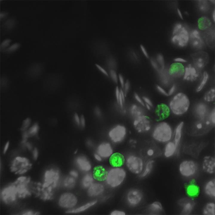 Protein Function Repairing Genetic Damage in Spermatogenesis Identified