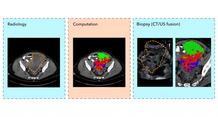 Individual and combined biopsy scans