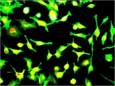 Microscope Image of Lung Cancer Cells