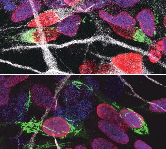 Mitochondrial Dynamics Influence Cell Fate