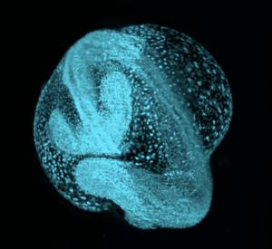 Zebrafish embryo