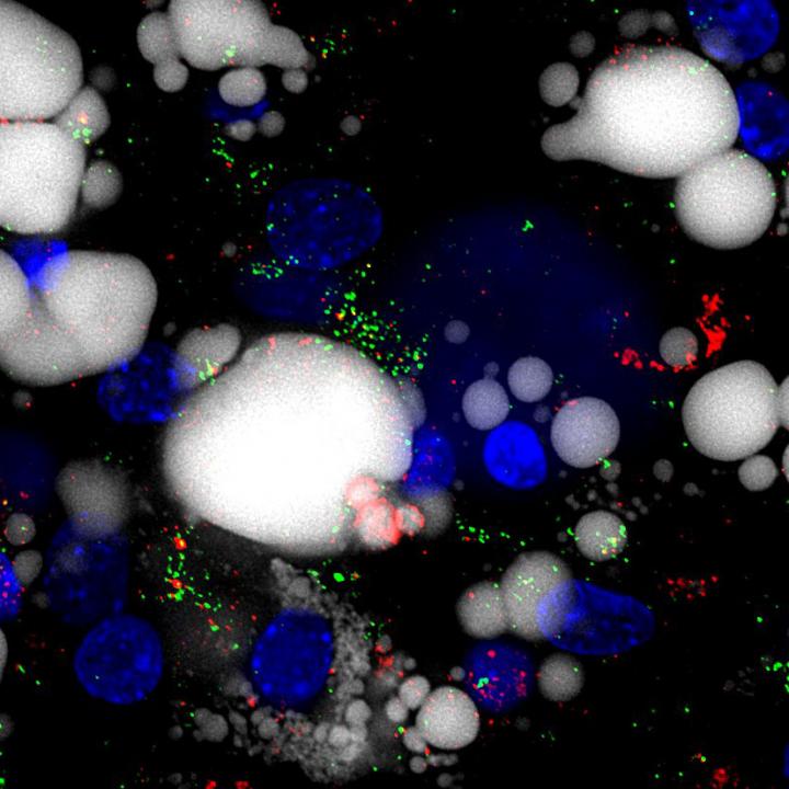 Microscopic Image of Fat Cells