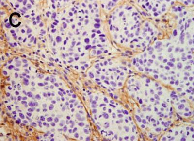 Formation of New Vessels