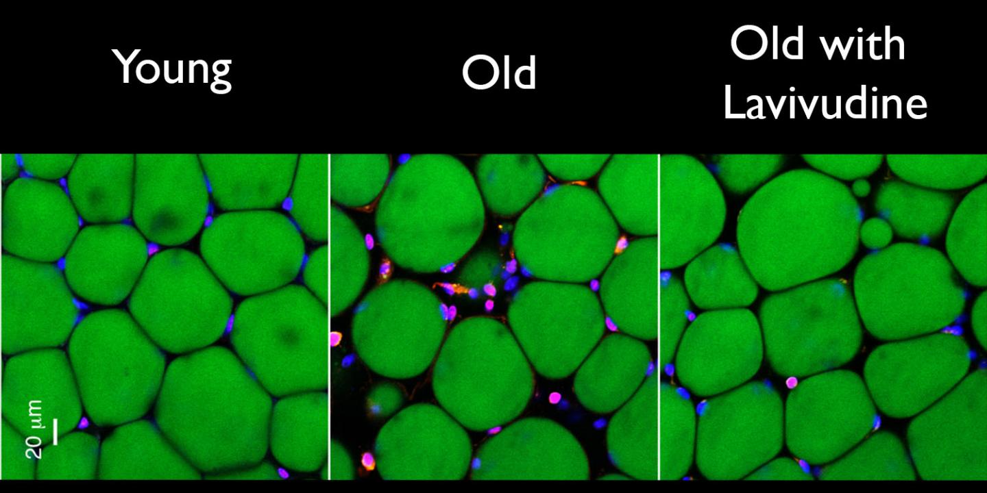 Signs of Aging in Mouse Fat Tissue