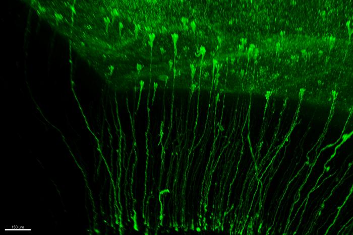 Diversity of Radial Glia cells