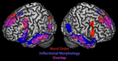 Highlighted Brain Region Juxtaposition