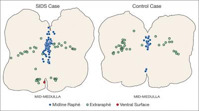 An Excess of Neurons