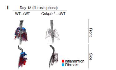 Resistance to Fibrosis