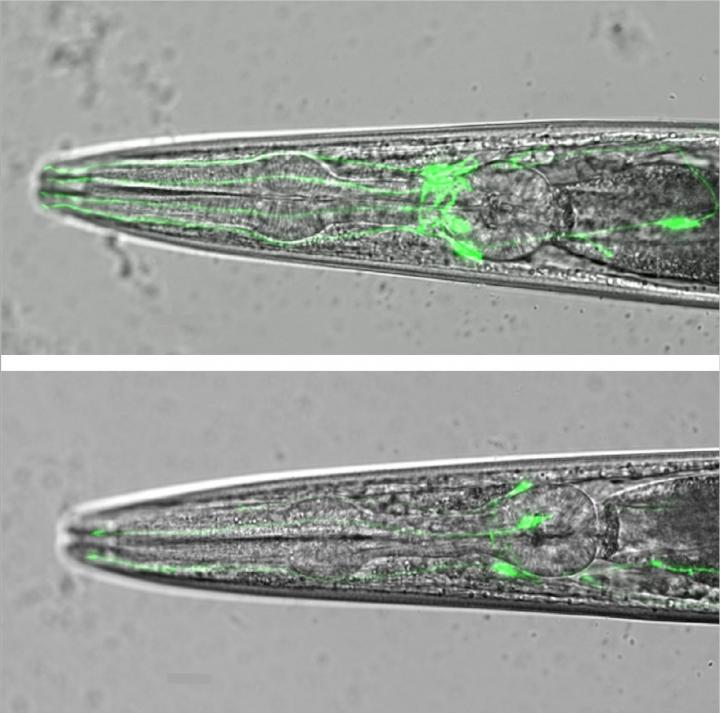 Mutation of Worm Gene, Swip-10, Triggers Age-Dependent Death of Dopamine Neurons