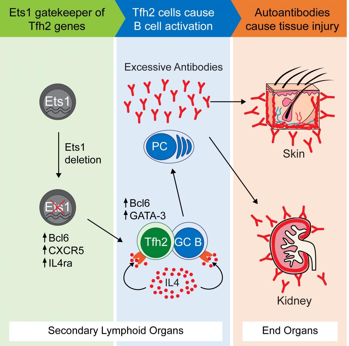 Lack of Ets1 Gene Leads to SLE