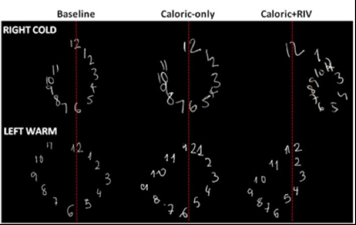 Clock Faces Illustrating Left and Right Brain Activation