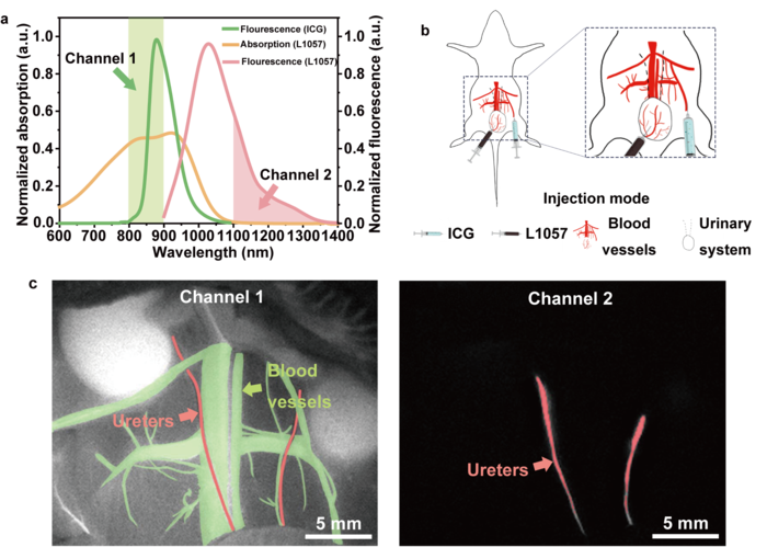 Multi-mode imaging of urinary system and blood vessels under the excitation of a single 915 nm CW laser