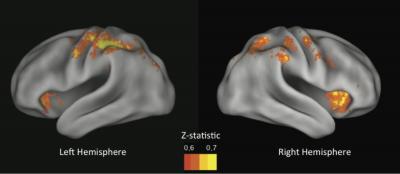 Brain Regions that Predict Risk-Taking