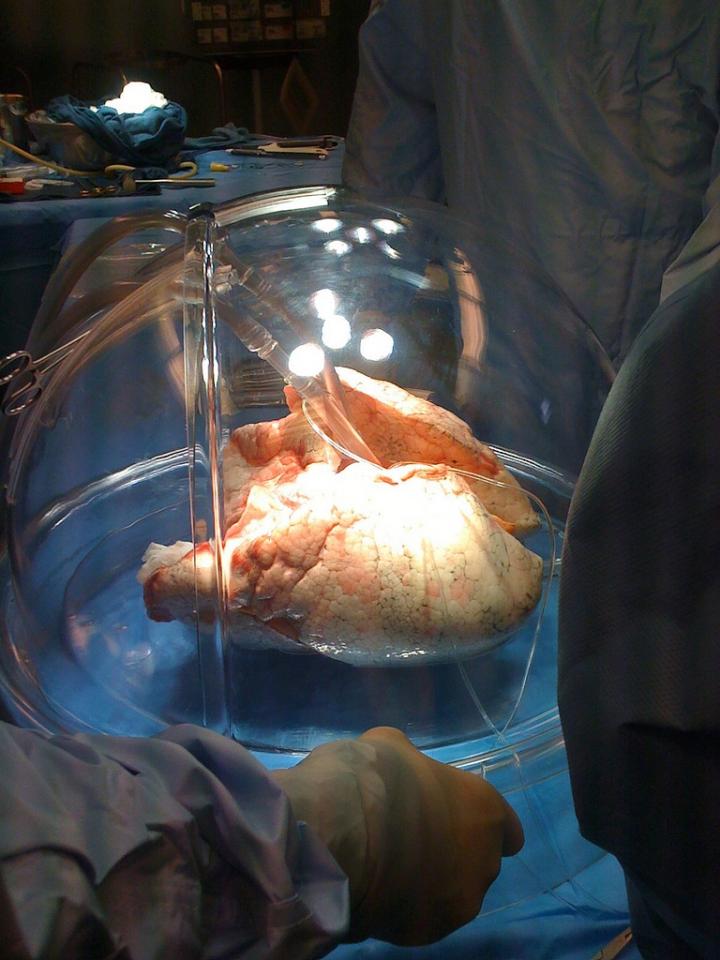 Ex Vivo Lung Perfusion System