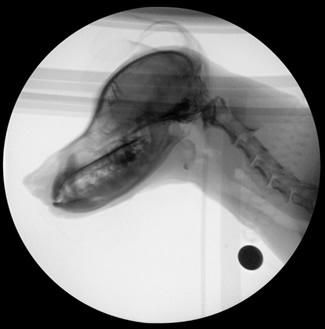 Fluoroscopic Swallow Study