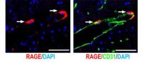 Figure 2. Expression of RAGE in the Brain Vascular Endothelial Cells of the Hippocampus