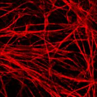 Neurons with Tau Mutation
