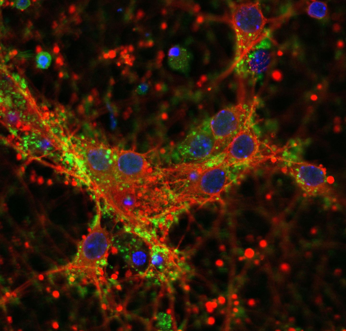 Protein Deposits &#945;-synuclein