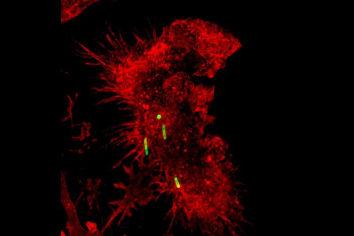 Macrophage (red fluorescent staining)