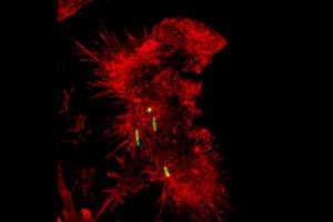 Macrophage (red fluorescent staining)