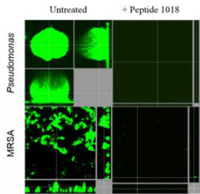 A Small Peptide that Targets Bacterial Biofilms
