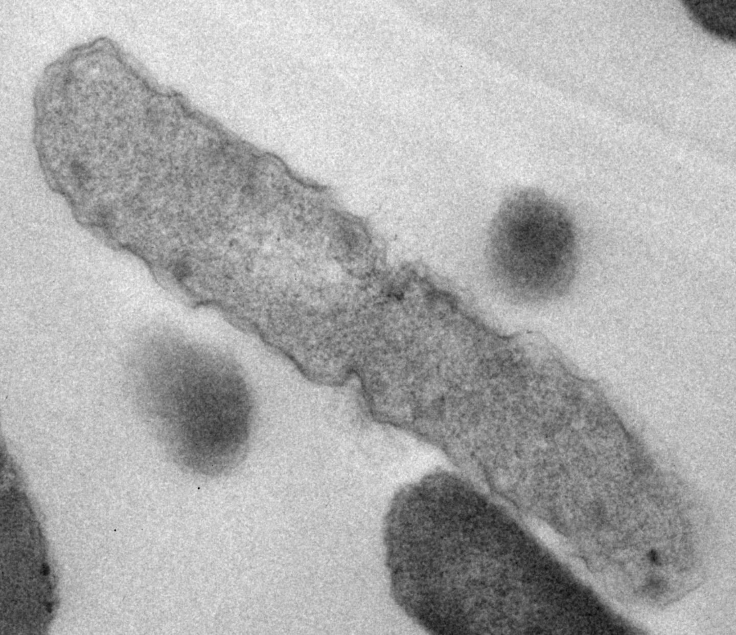 Dead Bacteria -- Microscopic