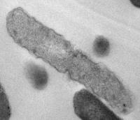 Dead Bacteria -- Microscopic