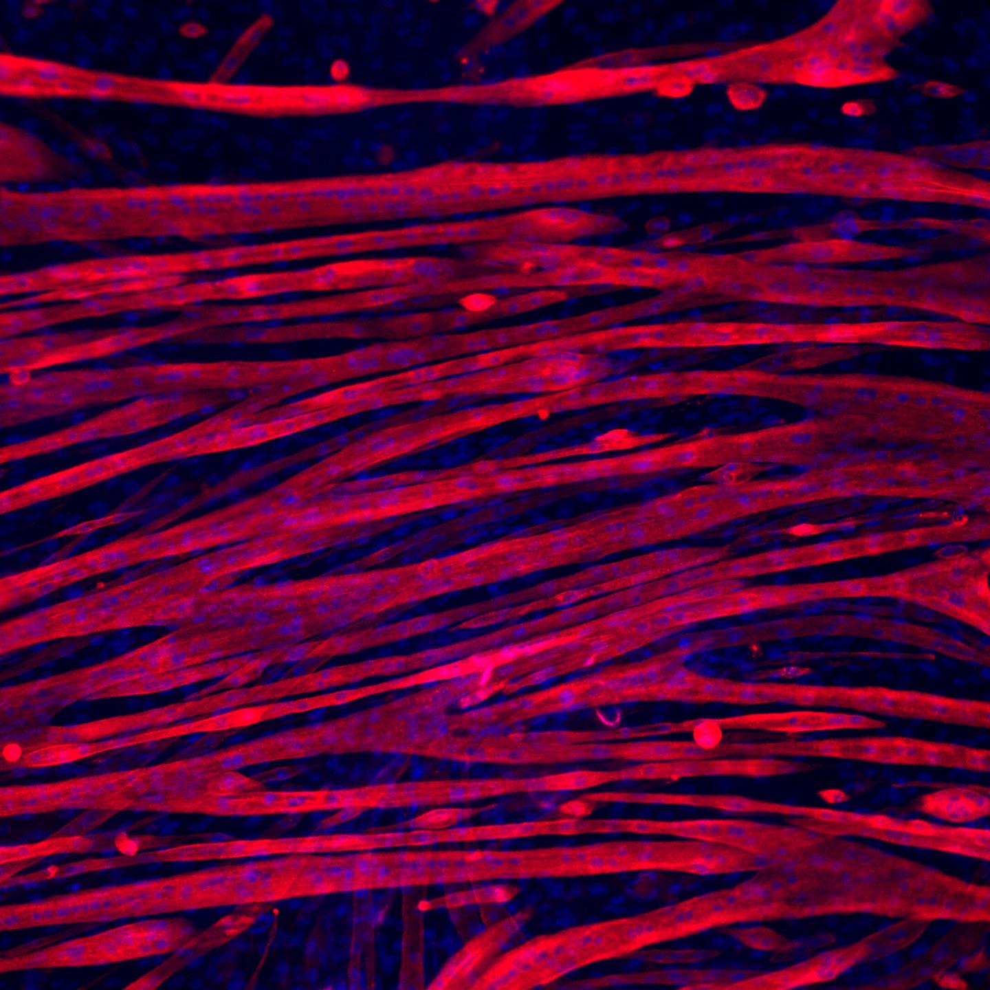 Skeletal Muscle Fibers