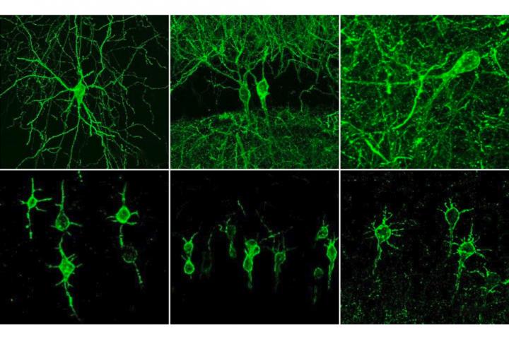 Imaging Neurons