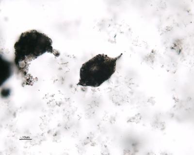 Spindle-Like Microfossils