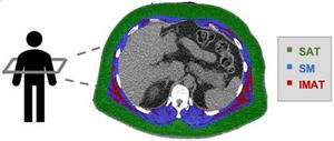 CT scan showing body composition in a section of torso