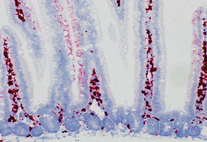 Small Intestine Mouse with high Fat Diet