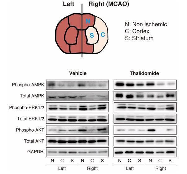 The Effect of Thalidomide On Neuroprotective Signalling Molecules In the MCAO/R Model