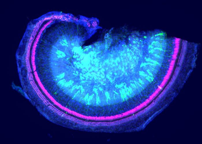 A view through the cochlea shows sensory hair cells that are important for hearing in pink after gene therapy