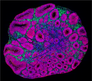 Brain organoid showing different cell types