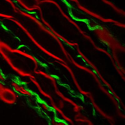Myelin Sheath and Astroglial Filaments