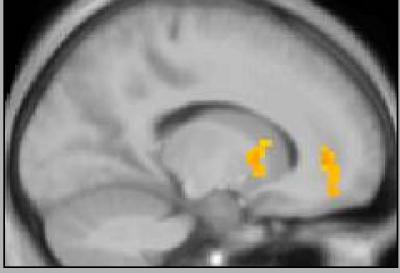 Brain fMRI