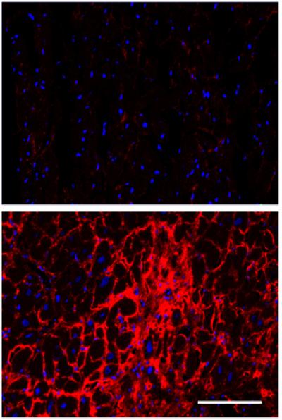 Molecule Nets Inside Heart Muscles