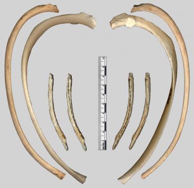 Human Evolution Takes a Twist [IMAGE] | EurekAlert! Science News Releases
