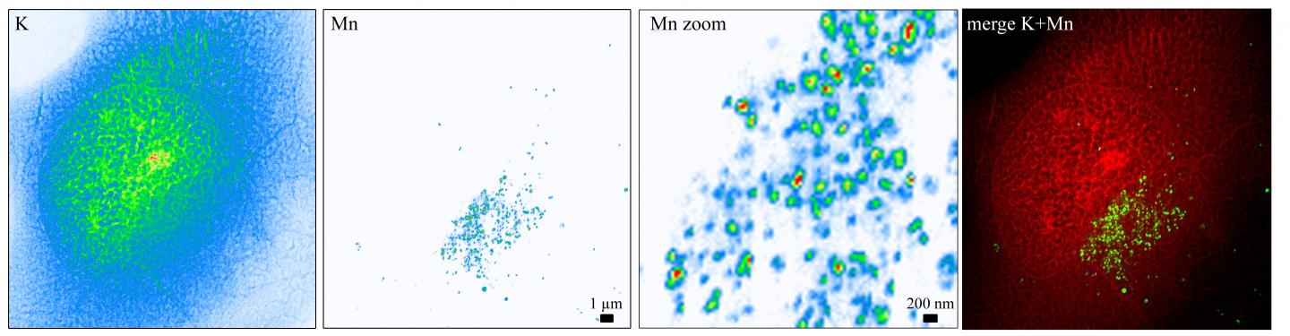Manganese Accumulates in Golgi Vesicles as a Result of SlC30A10 Mutation